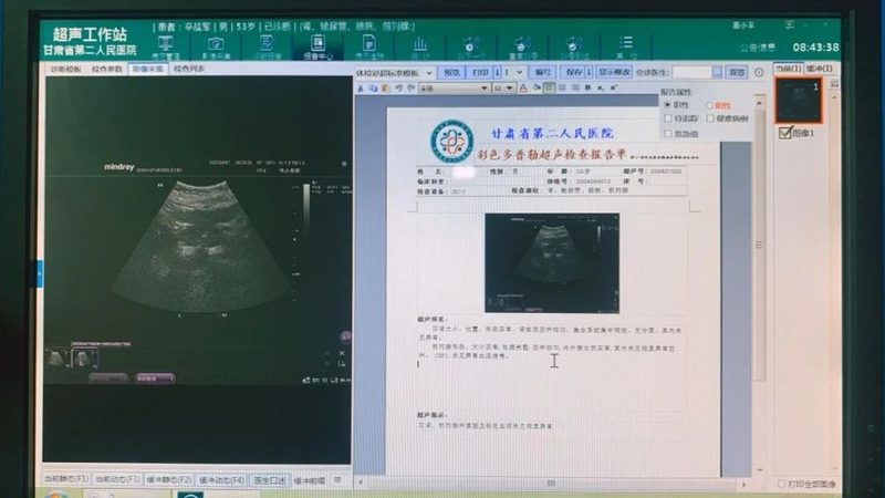 在职业健康体检中，以下指标尤为关键：